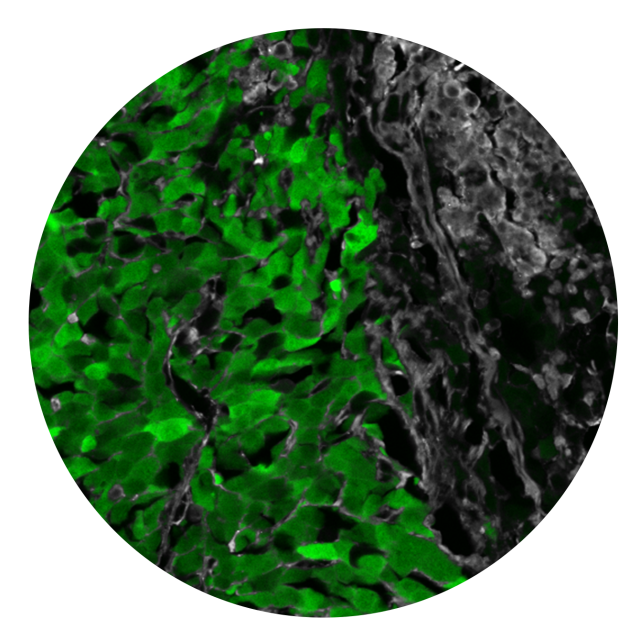 Green speckles intermix with black speckles in a round circle.